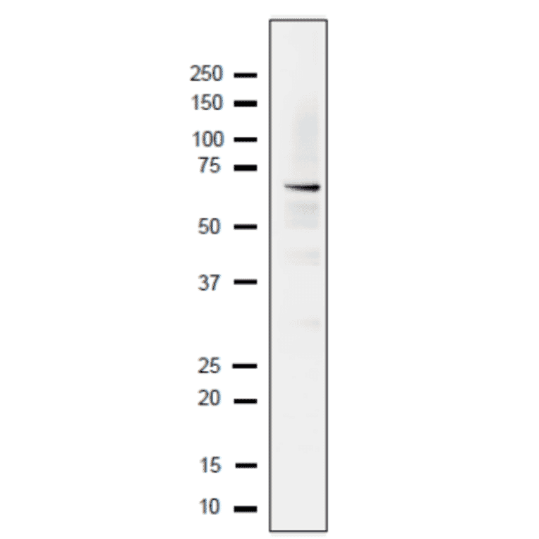 Detection of endogenous Rfa1 protein in whole cell extract of S. cerevisiae. The extract of strain BY4741 (10µg) was separated on SDS-PAGE 10-20% gradient gel. The Anti-Rfa1 Antibody was used at 1:2,000 dilution. Goat Anti-Rabbit IgG Antibody (HRP) was used as the secondary antibody at 1:10,000 dilution.