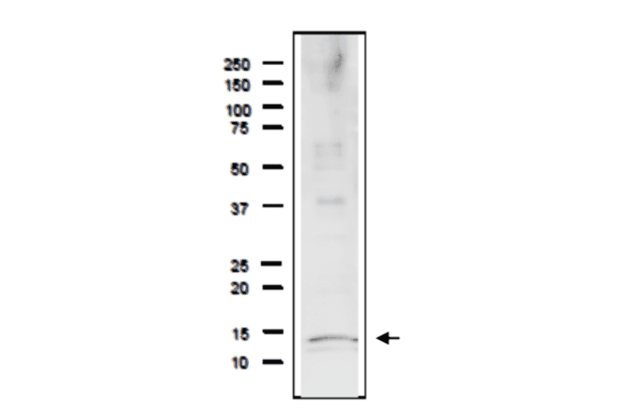 Detection of endogenous Rfa3 protein in whole cell extract of S. cerevisiae. The extract of strain BY4741 (20µg) was separated on SDS-PAGE 10-20% gradient gel. The Anti-Rfa1 Antibody was used at 1:2,000 dilution. Goat Anti-Rabbit IgG Antibody (HRP) was used as a secondary at 1:10,000 dilution. Molecular mass is 13.8 kDa.
