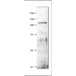 Western blot of Mcm6 / Mis5 protein. Anti-Mcm6 Antibody was used at 1:500 dilution. Goat Anti-Rabbit IgG Antibody (HRP) was used at 1:10,000 dilution. S. pombe extract (8µg). The antibody detects a protein band of 110 kDa, slightly larger than the one predicted from the protein sequence (95.5kDa).