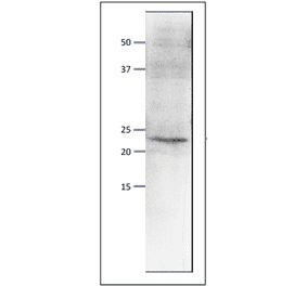 Western blot of endogenous Psf1 protein. Anti-Psf1 Antibody was used at 1:500 dilution. Goat Anti-Rabbit IgG Antibody (HRP) was used as a secondary at 1:10,000 dilution. S. pombe extract (8µg). The antibody detects the 23 kDa band, corresponding to the predicted molecular mass of Psf1 protein.