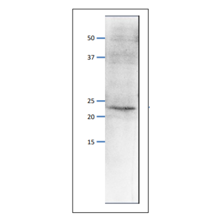 Western blot of endogenous Psf1 protein. Anti-Psf1 Antibody was used at 1:500 dilution. Goat Anti-Rabbit IgG Antibody (HRP) was used as a secondary at 1:10,000 dilution. S. pombe extract (8µg). The antibody detects the 23 kDa band, corresponding to the predicted molecular mass of Psf1 protein.