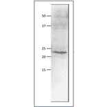 Western blot of endogenous Psf1 protein. Anti-Psf1 Antibody was used at 1:500 dilution. Goat Anti-Rabbit IgG Antibody (HRP) was used as a secondary at 1:10,000 dilution. S. pombe extract (8µg). The antibody detects the 23 kDa band, corresponding to the predicted molecular mass of Psf1 protein.