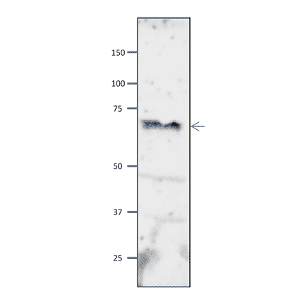 Western blot of Orc2 protein in S. pombe crude extract. Anti-Orc2 Antibody was used at 1:2,000 dilution. Goat Anti-Rabbit IgG Antibody (HRP) was used as a secondary at 1:10,000 dilution. S. pombe extract (8µg).