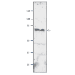 Western blot of Orc2 protein in S. pombe crude extract. Anti-Orc2 Antibody was used at 1:2,000 dilution. Goat Anti-Rabbit IgG Antibody (HRP) was used as a secondary at 1:10,000 dilution. S. pombe extract (8µg).