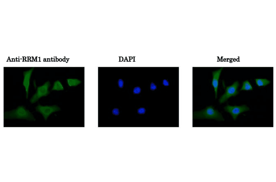 Immunofluorescence staining of HeLa cells with Anti-RRM1 Antibody. Cells were fixed with 4% PFA and permeabilized with 0.25% Triton X-100. Anti-RRM1 Antibody was used at 1/100 dilution.