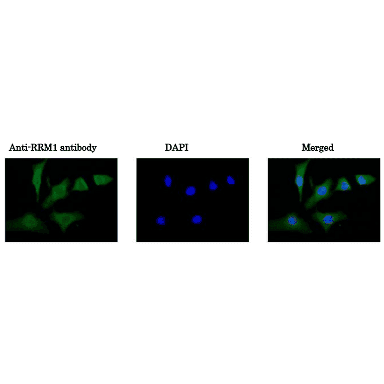 Immunofluorescence staining of HeLa cells with Anti-RRM1 Antibody. Cells were fixed with 4% PFA and permeabilized with 0.25% Triton X-100. Anti-RRM1 Antibody was used at 1/100 dilution.