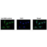 Immunofluorescence staining of HeLa cells with Anti-RRM1 Antibody. Cells were fixed with 4% PFA and permeabilized with 0.25% Triton X-100. Anti-RRM1 Antibody was used at 1/100 dilution.
