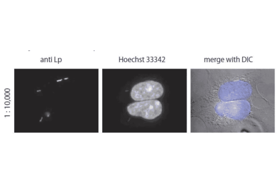 Immunofluorescent staining of Legionella pneumophila in the infected HEK293 cells using anti-Legionella pneumophila antibody.
