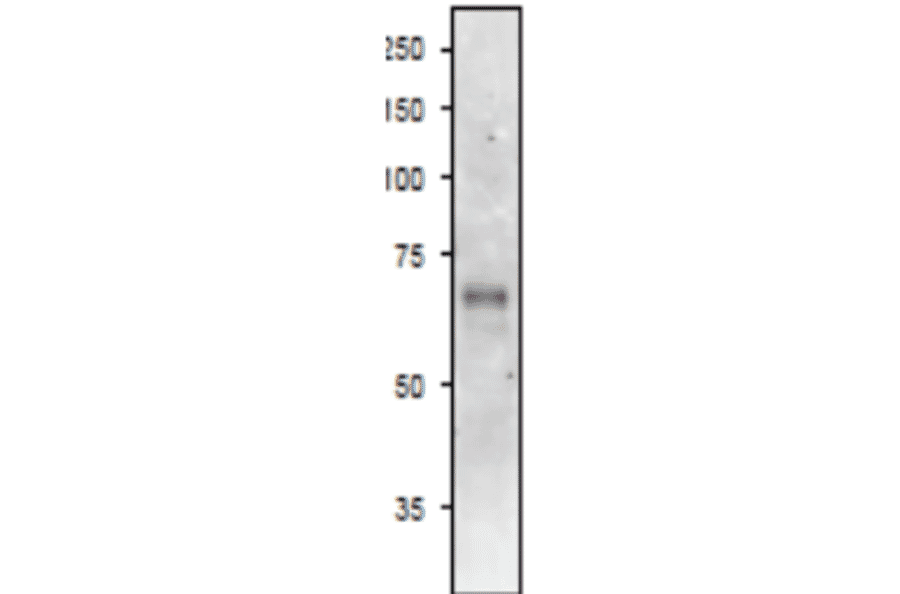 Western Blot of ASN2 in arabidopsis leaf extract.