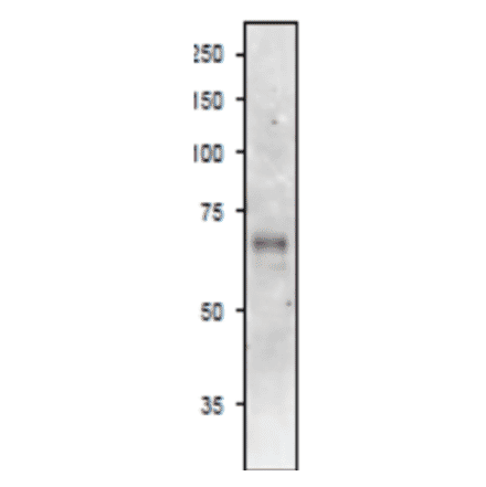 Western Blot of ASN2 in arabidopsis leaf extract.
