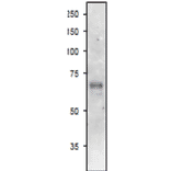 Western Blot of ASN2 in arabidopsis leaf extract.