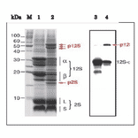 Western Blot of the precursor 12S globulin and 12S-asubunit of the mature forms in extract of arabidopsis dry seeds.