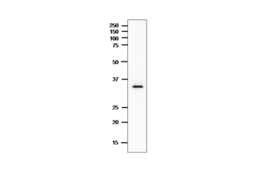 Western Blot of CPE in the crude extract of C. perfringens.