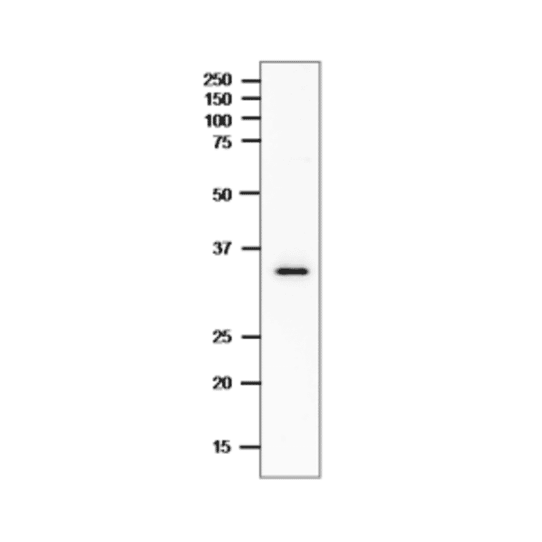 Western Blot of CPE in the crude extract of C. perfringens.