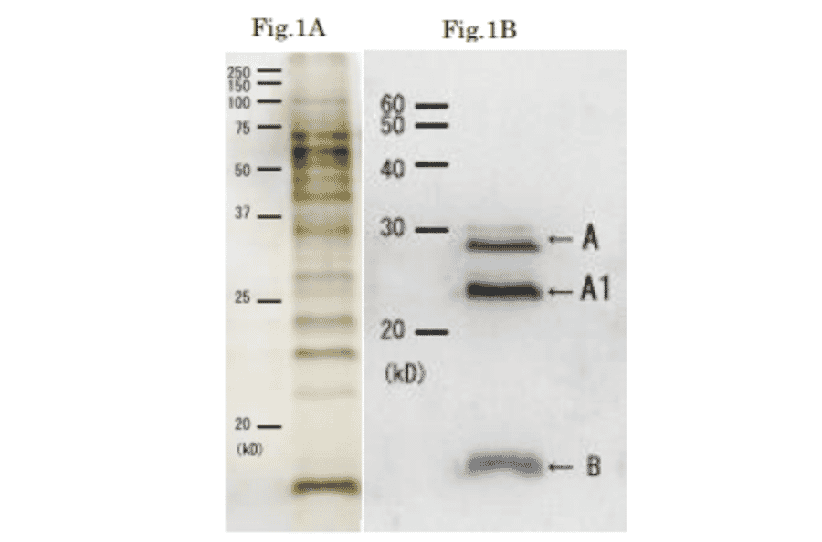 Western blotting of culture medium of Cholera toxin.