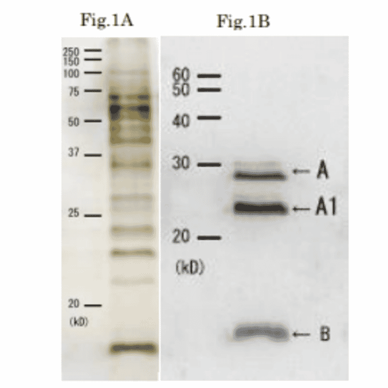 Western blotting of culture medium of Cholera toxin.