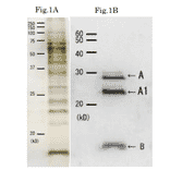 Western blotting of culture medium of Cholera toxin.