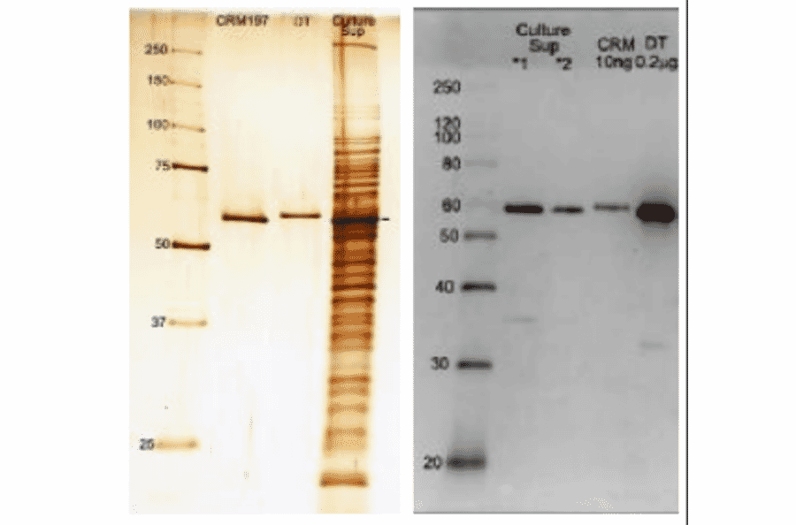 Figure1 (left): SDS-PAGE analysis of culture medium of Corynebacterium Diphtheria.