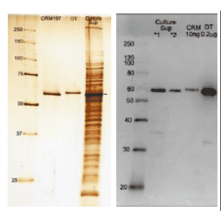 Figure1 (left): SDS-PAGE analysis of culture medium of Corynebacterium Diphtheria.