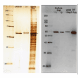 Figure1 (left): SDS-PAGE analysis of culture medium of Corynebacterium Diphtheria.