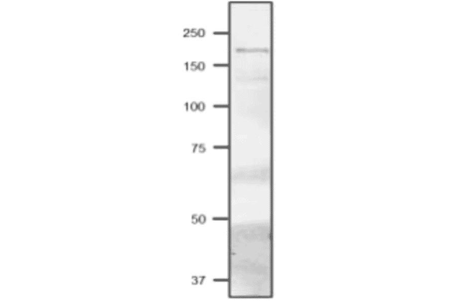 Western Blot of Fd-GOGAT in Cyanobacterium