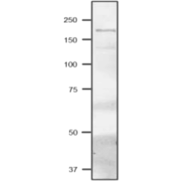 Western Blot of Fd-GOGAT in Cyanobacterium