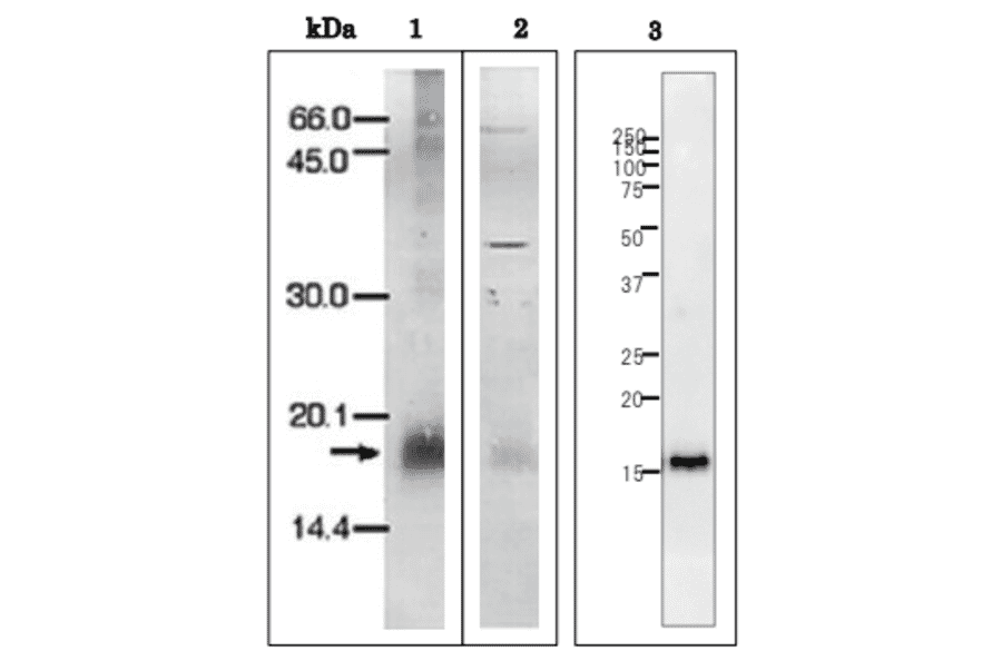 Western Blot of P. falciparum.Ferredoxin.