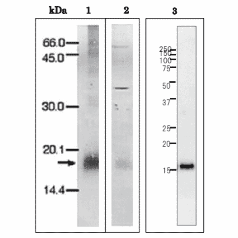 Western Blot of P. falciparum.Ferredoxin.
