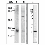 Western Blot of P. falciparum.Ferredoxin.