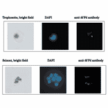 Immunofluorescence stainig of ferredoxin in P. alciparum.