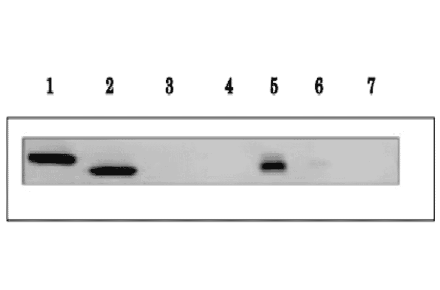 Detection of Arabidopsis Ferredoxin isoproteins, 1 and 2 by western blotting with anti- Ferredoxin-1 (maize) antibody.