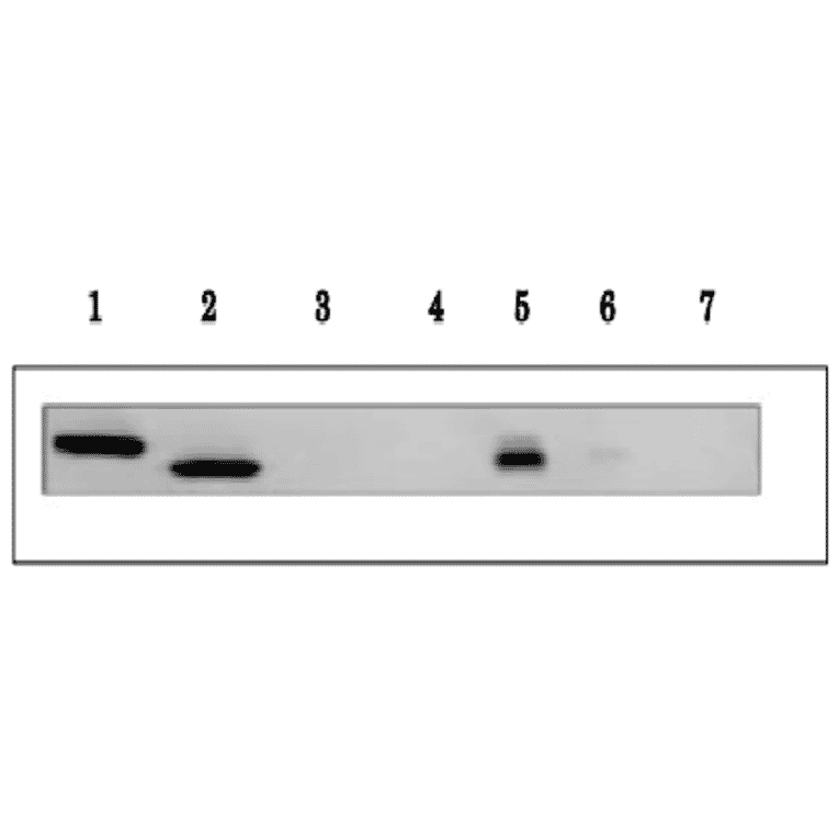 Detection of Arabidopsis Ferredoxin isoproteins, 1 and 2 by western blotting with anti- Ferredoxin-1 (maize) antibody.