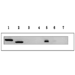 Detection of Arabidopsis Ferredoxin isoproteins, 1 and 2 by western blotting with anti- Ferredoxin-1 (maize) antibody.