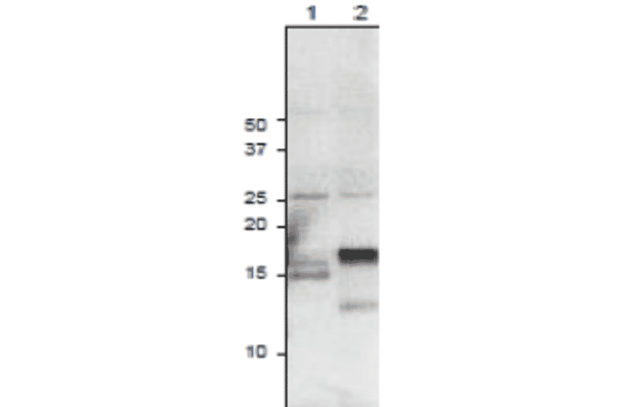 Western Blot of root ferredoxins expressed in plant leaves as detected with anti-Ferredoxin-3 antibody