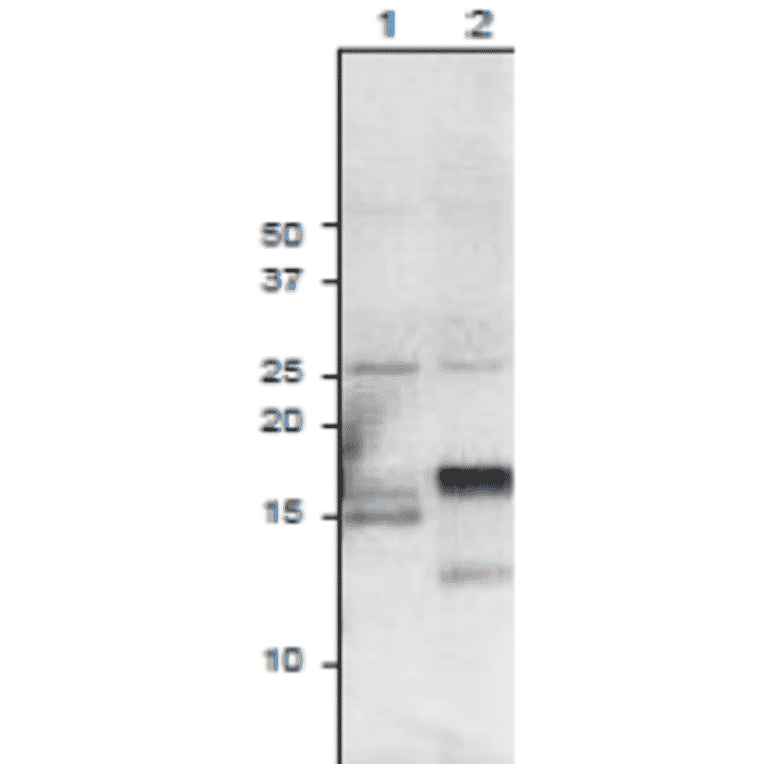 Western Blot of root ferredoxins expressed in plant leaves as detected with anti-Ferredoxin-3 antibody