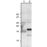 Western Blot of root ferredoxins expressed in plant leaves as detected with anti-Ferredoxin-3 antibody