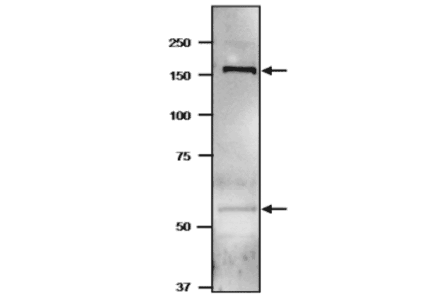 Western blot of GltBD protein in cyanobacterium.