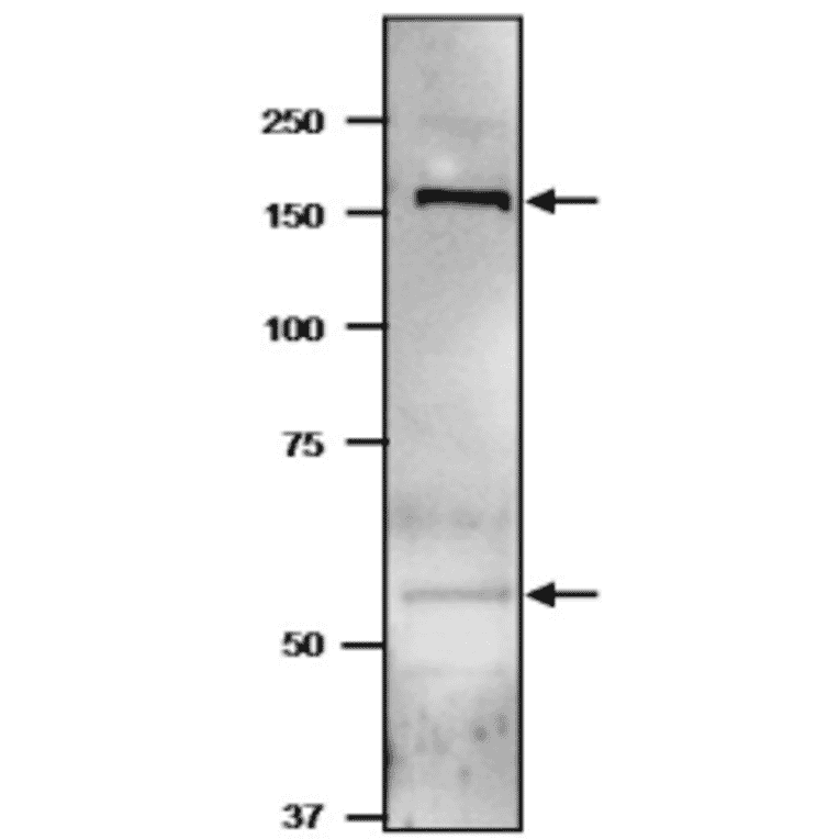 Western blot of GltBD protein in cyanobacterium.