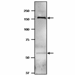 Western blot of GltBD protein in cyanobacterium.