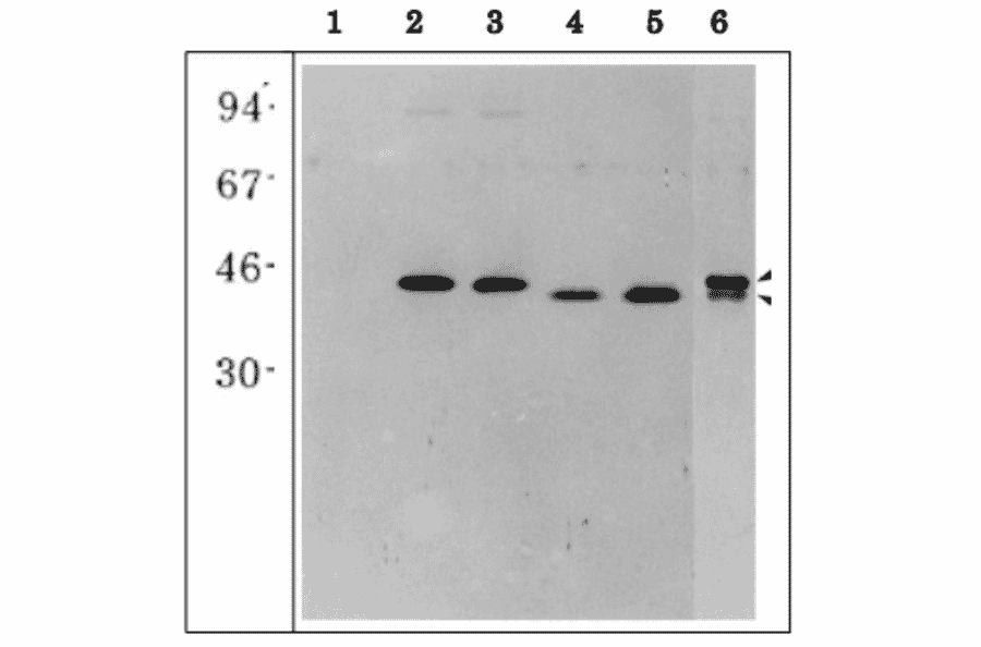 Western blot of E. coli extracts overexpressing recombinant maize root type GS isoproteins.