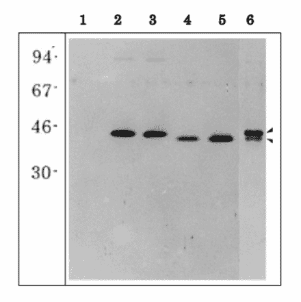Western blot of E. coli extracts overexpressing recombinant maize root type GS isoproteins.