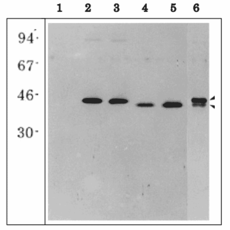 Western blot of E. coli extracts overexpressing recombinant maize root type GS isoproteins.