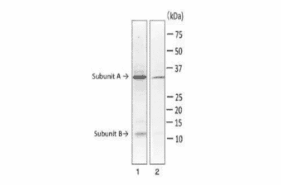 Western blot of LT toxin in extract of E. coli ETEC strain