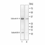 Western blot of LT toxin in extract of E. coli ETEC strain