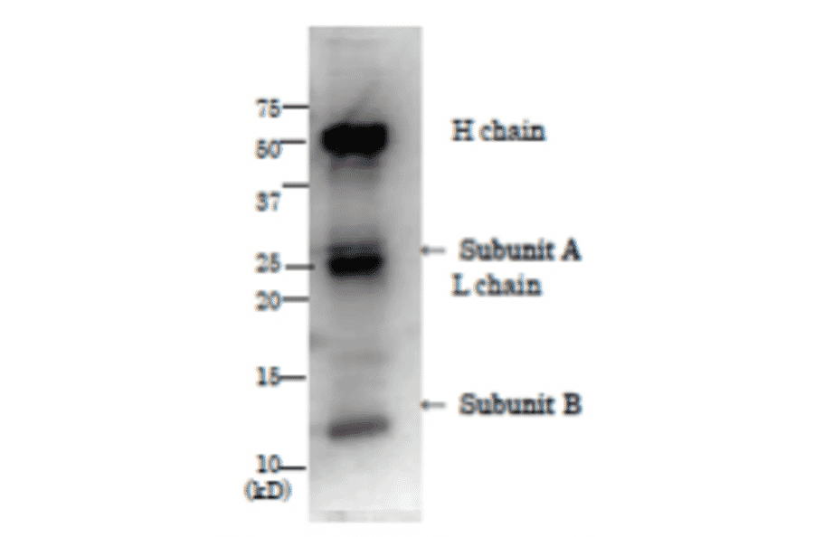 Immunopprecipitation of LT from culture medium of ETEC by using anti-LT antibody.