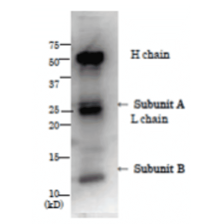 Immunopprecipitation of LT from culture medium of ETEC by using anti-LT antibody.