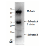 Immunopprecipitation of LT from culture medium of ETEC by using anti-LT antibody.