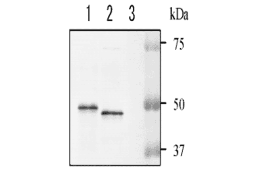 Detection of NADase in the culture supernatant of hemolytic