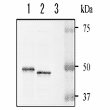 Detection of NADase in the culture supernatant of hemolytic