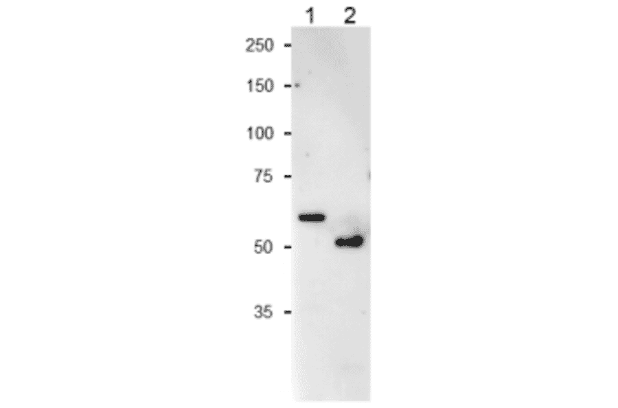 Western Blot of NiR protein of Cyanobacterium and Spinacch